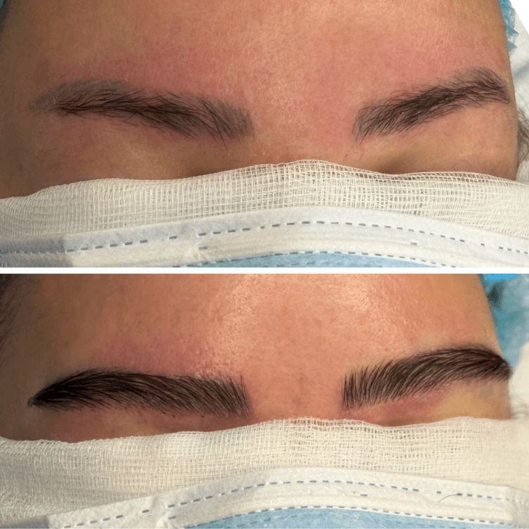 Diseño y cuidado de cejas: antes y después