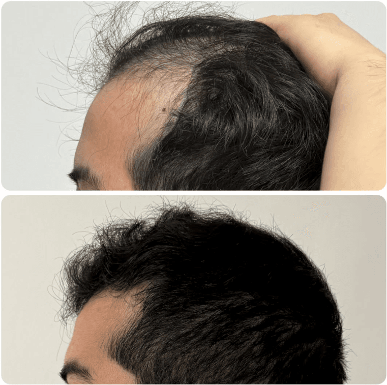 Hair treatment: before and after