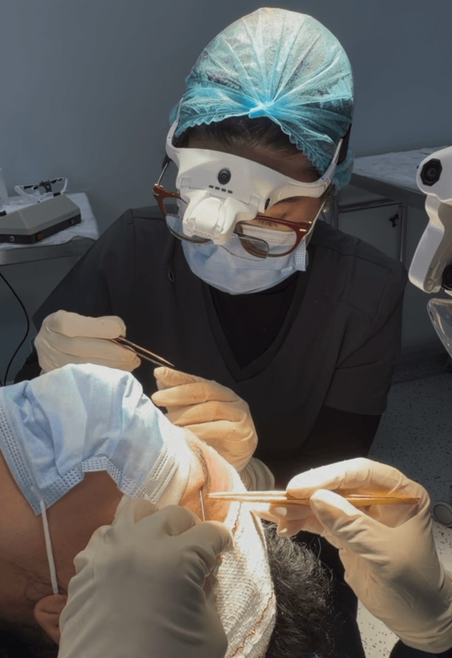 Implantación folículo a folículo en la ceja.